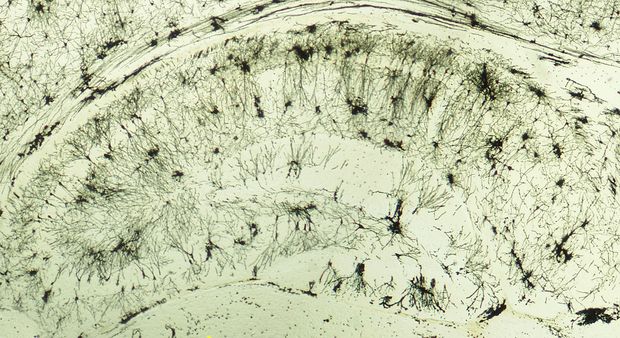 Patkány hippokampuszának keresztmetszetén Golgi-festéssel megjelenített serkentő (piramis-) sejtek láthatók