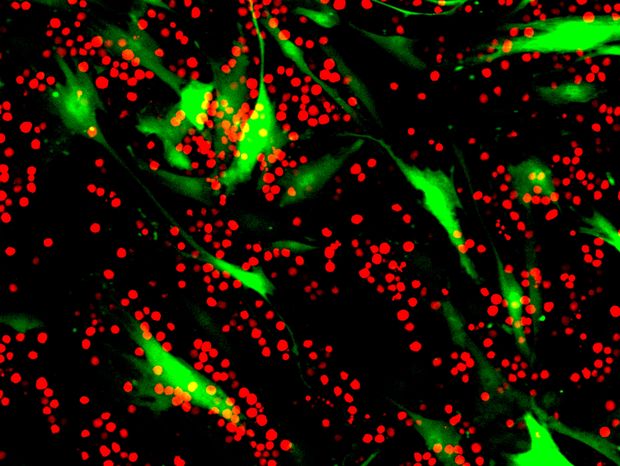 Zölden fluoreszkáló kötőszöveti őssejtek harca leukémiás sejtekkel (piros, kerek foltok). Ilyen automatikusan készülő time lapse fotókkal dokumentálják a kutatás során a küzdelmet. 