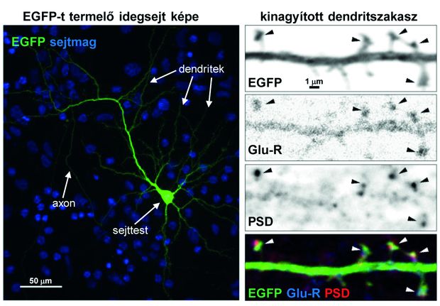 Egy zöld fluoreszcens fehérjét termelő idegsejt képe és kinagyított dendritszakasza