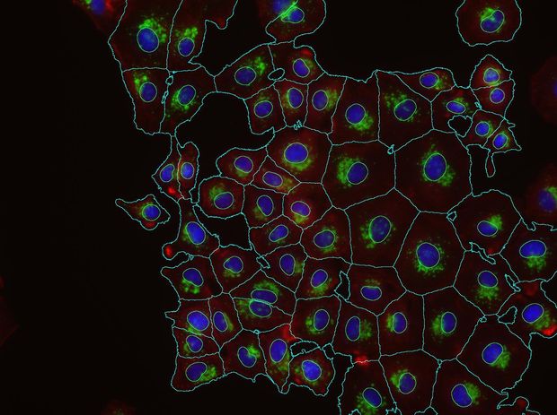 Mikroszkópos felvétel influenzavírusokat (zöld) tartalmazó sejtekről. Képanalizáló eljárások segítségével a sejtmag (kék) és a citoplazma (piros) automatikusan lett detektálva akár több tízmillió hasonló képen.