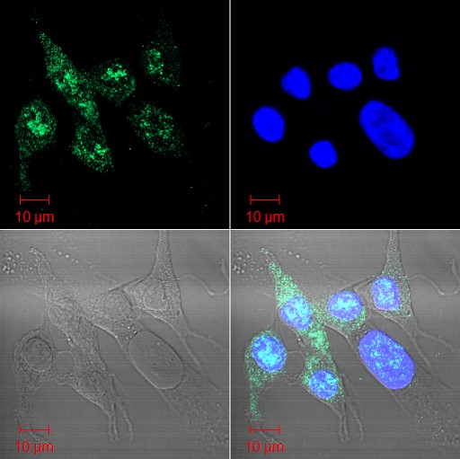  Izolált vesesejtek, zöld jelöli a Sigma-1 receptort, kék a sejtmagot