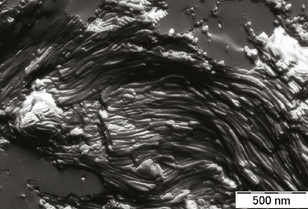 Lipid nanocső, FF-TEM felvétel