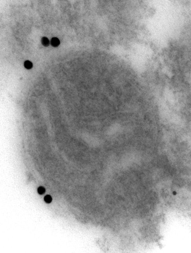 Emberi agyból készített elektronmikroszkópos felvétel egy mitokondriumról. A fekete pöttyök aranyszemcsék, melyekkel az alfa-szinuklein kóros formáját jelöltük. Ezek a mitokondriumok külső membránjához rögzülnek, s így vélhetően megzavarják azok működését. (LÁSZLÓ LAJOS FELVÉTELE)