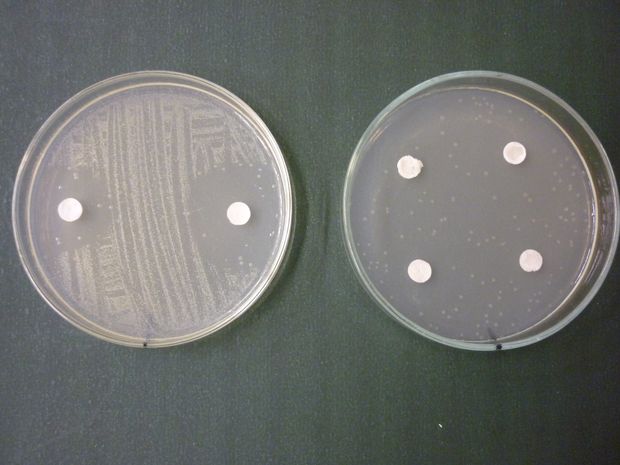 Streptococcus-tenyészet, amelyet különböző koncentrációjú levendula-illóolajjal (balra), illetve menta-illóolajjal (jobbra) kezeltünk